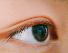 倒睫是由什么原因引起的？